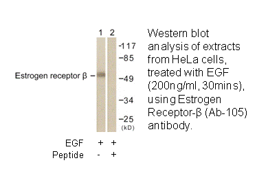 Product image for Estrogen Receptor-&beta; (Ab-105) Antibody
