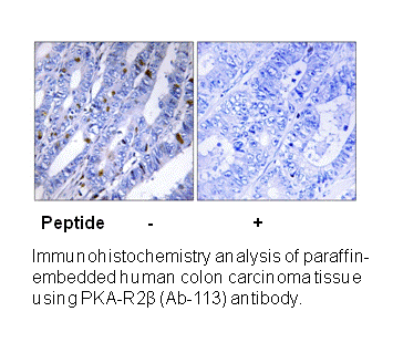 Product image for PKA-R2&beta; (Ab-113) Antibody