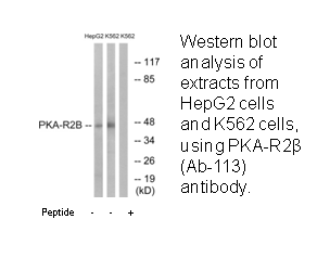 Product image for PKA-R2&beta; (Ab-113) Antibody