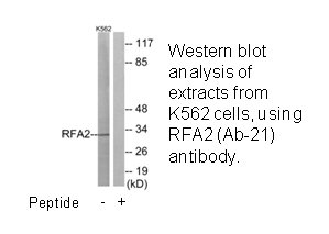 Product image for RFA2 (Ab-21) Antibody