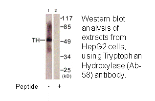 Product image for Tryptophan Hydroxylase (Ab-58) Antibody