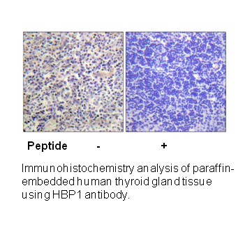 Product image for HBP1 (Ab-402) Antibody