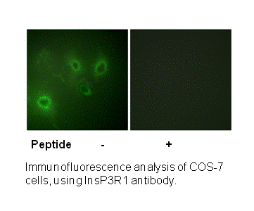 Product image for InsP3R1 (Ab-1598/1588) Antibody