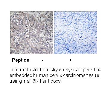 Product image for InsP3R1 (Ab-1598/1588) Antibody