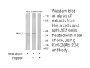 Product image for Kir6.2 (Ab-224) Antibody