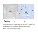 Product image for Kv4.2/KCND2 (Ab-616) Antibody