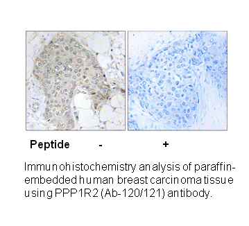 Product image for PPP1R2 (Ab-120/121) Antibody