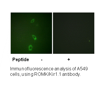 Product image for ROMK/Kir1.1 (Ab-44/25) Antibody