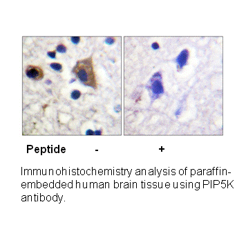 Product image for PIP5K (Ab-307) Antibody