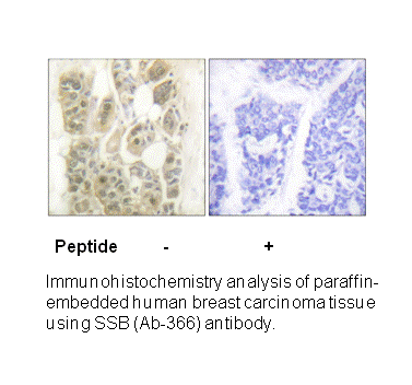 Product image for SSB (Ab-366) Antibody