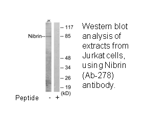 Product image for Nibrin (Ab-278) Antibody