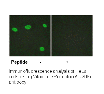 Product image for Vitamin D Receptor (Ab-208) Antibody