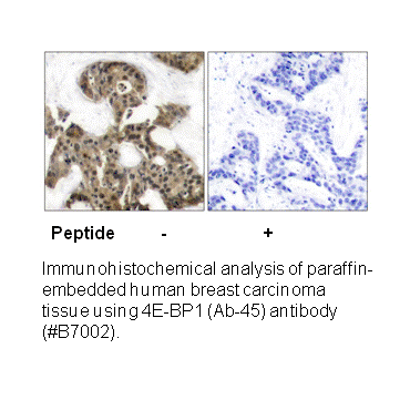 Product image for 4E-BP1 (Ab-45) Antibody