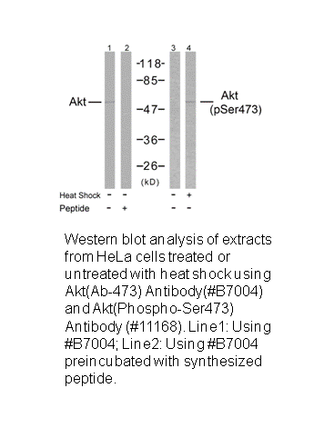 Product image for Akt (Ab-473) Antibody