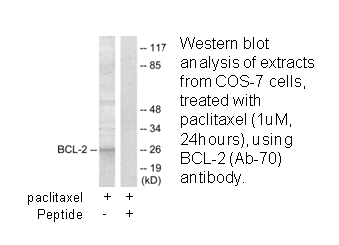 Product image for BCL-2 (Ab-70) Antibody