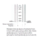 Product image for Cofilin (Ab-3) Antibody