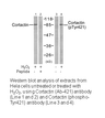Product image for Cortactin (Ab-421) Antibody