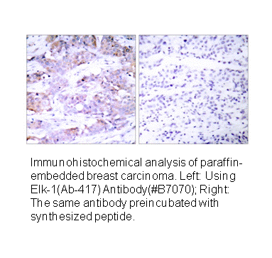 Product image for Elk1 (Ab-417) Antibody