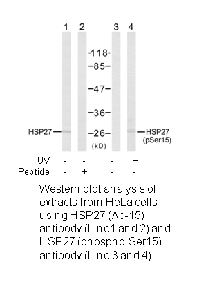 Product image for HSP27 (Ab-15) Antibody