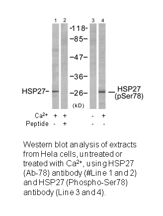 Product image for HSP27 (Ab-78) Antibody