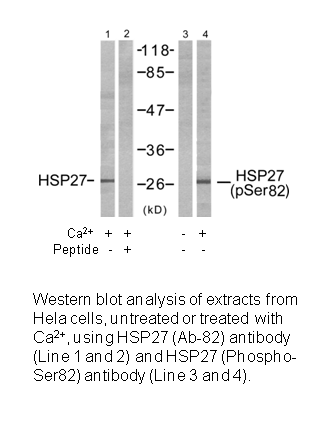 Product image for HSP27 (Ab-82) Antibody