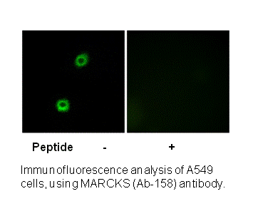 Product image for MARCKS (Ab-158) Antibody