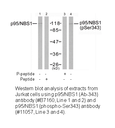 Product image for p95/NBS1 (Ab-343) Antibody