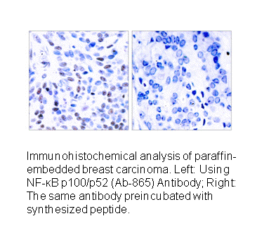 Product image for NF-&kappa;B p100/p52 (Ab-865) Antibody