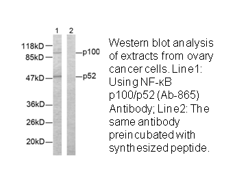 Product image for NF-&kappa;B p100/p52 (Ab-865) Antibody