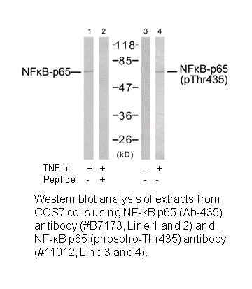 Product image for NF-&kappa;B p65 (Ab-435) Antibody