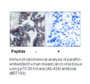 Product image for p70 S6 Kinase (Ab-424) Antibody