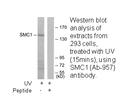 Product image for SMC1 (Ab-957) Antibody