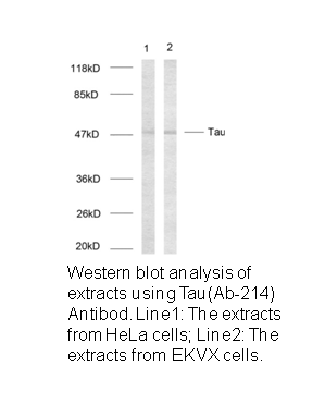 Product image for Tau (Ab-214) Antibody