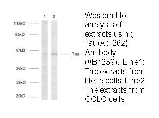 Product image for Tau (Ab-262) Antibody