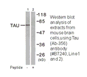 Product image for Tau (Ab-356) Antibody
