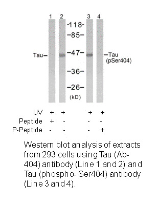 Product image for Tau (Ab-404) Antibody