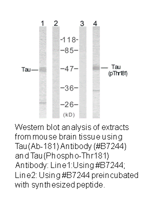 Product image for Tau (Ab-181) Antibody
