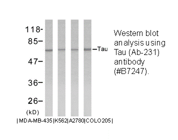 Product image for Tau (Ab-231) Antibody