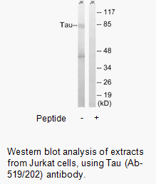 Product image for Tau (Ab-519/202) Antibody