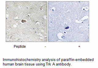Product image for Trk A (Ab-701) Antibody