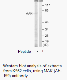 Product image for MAK (Ab-159) Antibody