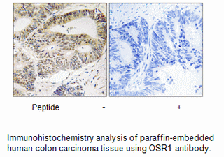 Product image for OSR1 (Ab-185) Antibody