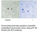 Product image for p70 S6 Kinase (Ab-427) Antibody