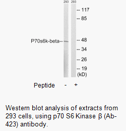 Product image for p70 S6 Kinase &beta; (Ab-423) Antibody