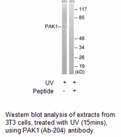 Product image for PAK1 (Ab-204) Antibody