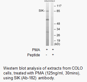 Product image for SIK (Ab-182) Antibody