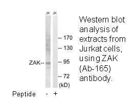 Product image for ZAK (Ab-165) Antibody