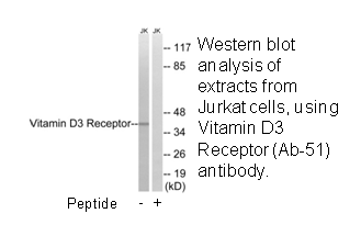 Product image for Vitamin D3 Receptor (Ab-51) Antibody