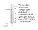 Product image for SLP-76 (Ab-128) Antibody