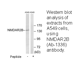 Product image for NMDAR2B (Ab-1336) Antibody